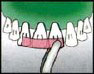 Наложите на шинируемые зубы