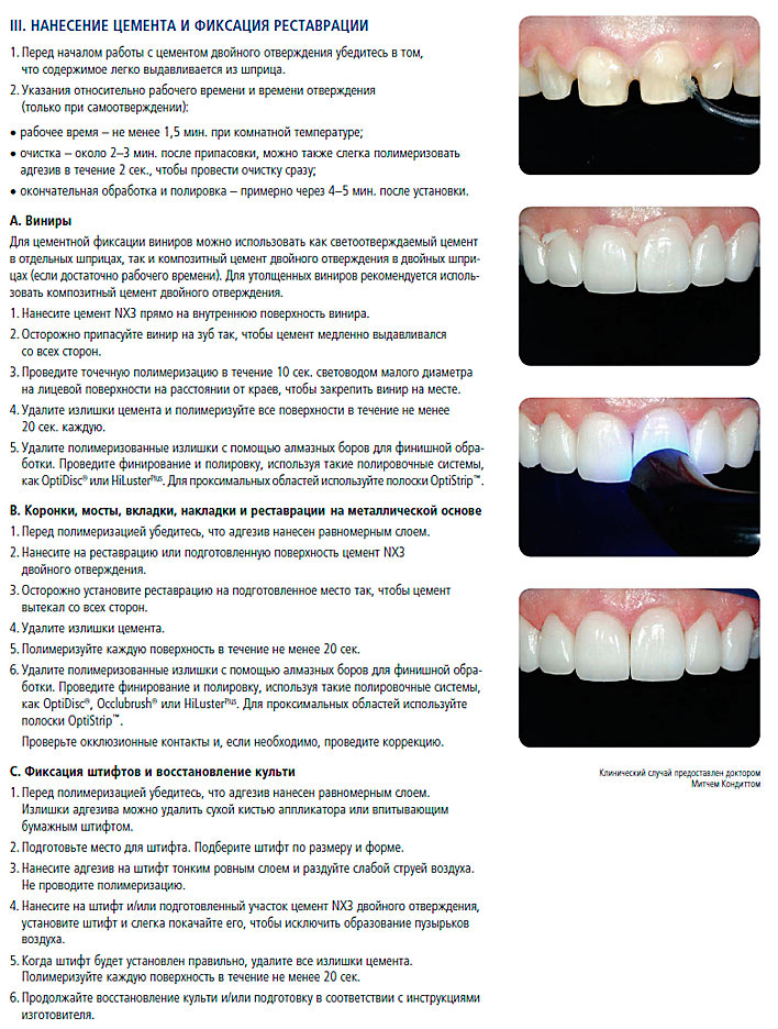 Протокол в ортопедической стоматологии